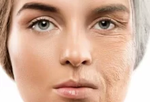 تغییرات چهره بعد از ترک سیگار : 5 تاثیر شگفت انگیز در 1 ماه 20 تغییرات چهره بعد از ترک سیگار